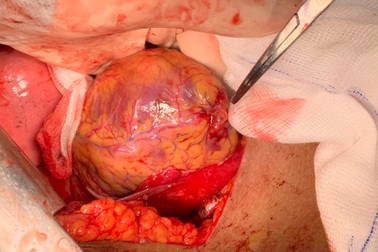 Người phụ nữ bị đâm thấu tim khi đi bộ trong hẻm Sài Gòn