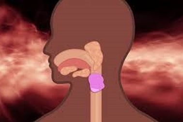 Điều gì sẽ xảy ra khi bạn nuốt kẹo cao su?