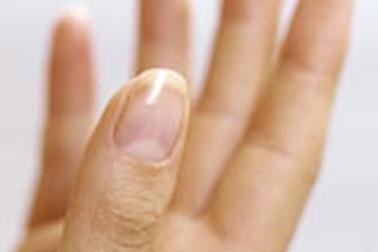Làm trắng móng tay
