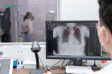 Khó nhận biết bệnh tim mạch vì dấu hiệu mờ nhạt