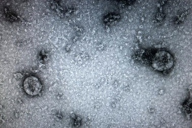 Virus SARS-CoV-2 tại Việt Nam gồm 2 nhánh khác nhau