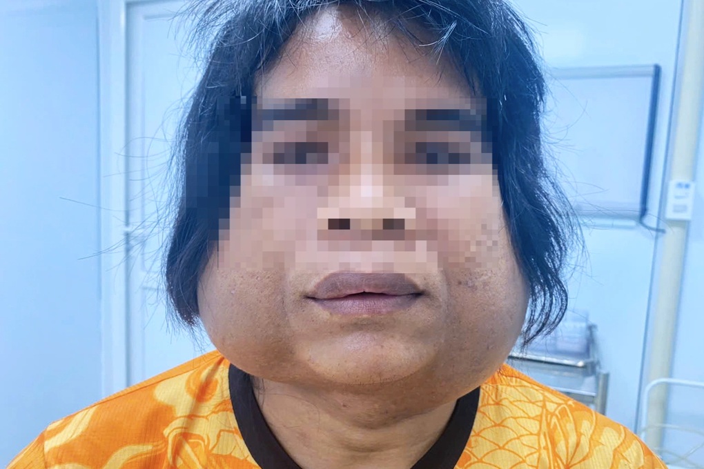 Chàng trai 10 năm mang 2 khối u lạ, mổ xong lại mọc lên và phình to - 1 Chàng trai 10 năm mang 2 khối u lạ, mổ xong lại mọc lên và phình to - 1