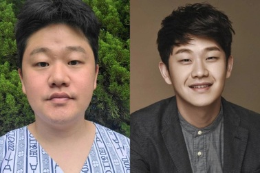 Nam ca sĩ xứ Hàn thừa nhận giả mắc ung thư để kêu gọi ủng hộ