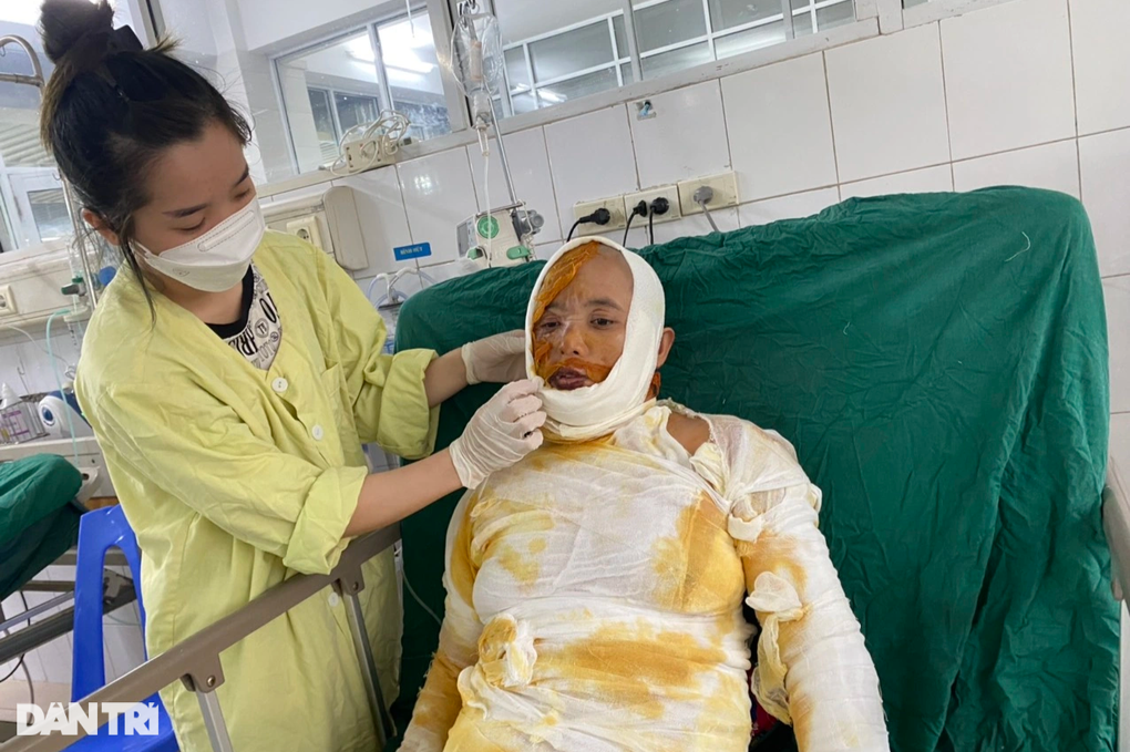 Bạn đọc Dân trí giúp đỡ đôi vợ chồng nghèo bị bỏng nặng hơn 108 triệu đồng - 2 Bạn đọc Dân trí giúp đỡ đôi vợ chồng nghèo bị bỏng nặng hơn 108 triệu đồng - 2