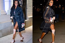 Winnie Harlow ăn vận quá gợi cảm