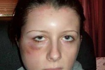 Sẽ chết nếu nhuộm tóc tiếp