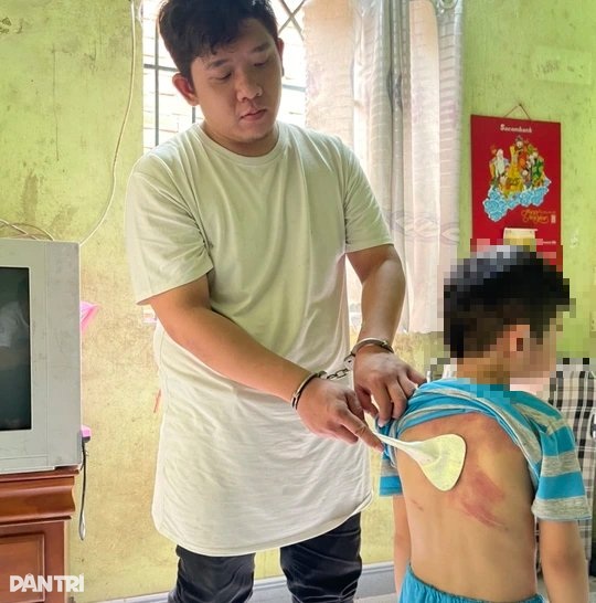 אב התעלל שוב ושוב בילד בן 5 באמצעות מטען לטלפון - 1 Người cha dùng dây sạc điện thoại nhiều lần bạo hành con 5 tuổi - 1