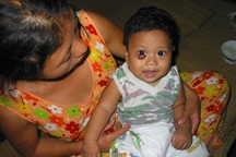 Cùng thắp sáng hi vọng cho bé 7 tháng tuổi bị u máu