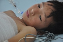 Đùa nghịch với bạn, cậu bé 10 tuổi dân tộc Dao bỏng cồn kinh hoàng