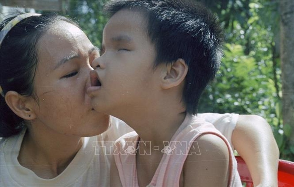 Thảm họa da cam ở Việt Nam: Cuộc chiến thảm khốc! - 1 Thảm họa da cam ở Việt Nam: Cuộc chiến thảm khốc! - 1