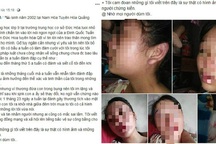 Mẹ trẻ 16 tuổi lên Facebook cầu cứu vì bị chồng bạo hành