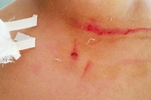 Thầy giáo thừa nhận tát, đá và đạp học sinh