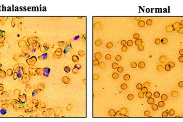 Phát triển chiến lược chỉnh sửa gen mới để sửa chữa đột biến