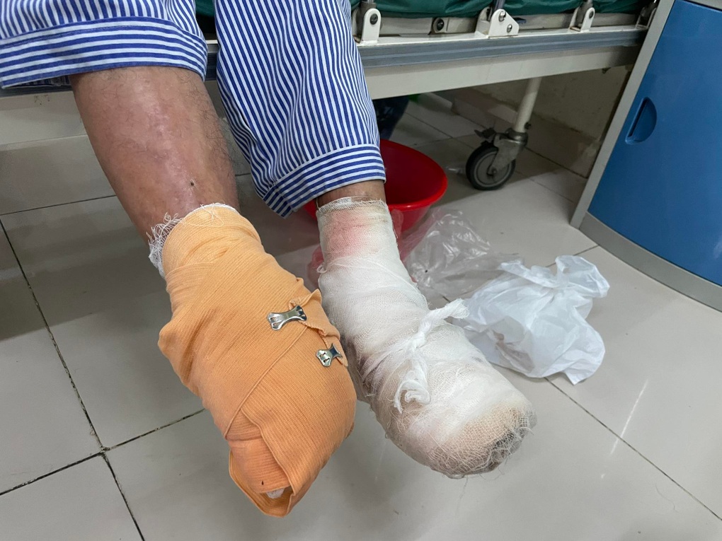 Người đàn ông bị cắt cả 2 bàn chân vì căn bệnh 5 triệu người Việt mắc phải - 2 Người đàn ông bị cắt cả 2 bàn chân vì căn bệnh 5 triệu người Việt mắc phải - 2