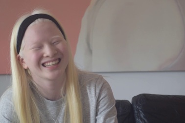 Cô bé bạch tạng bị bỏ rơi trở thành người mẫu