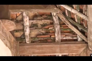 Hai anh em mắc bệnh tan máu bẩm sinh