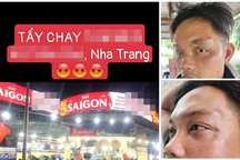 Du khách tố bị "8, 9 nhân viên" quán hải sản ở Nha Trang hành hung