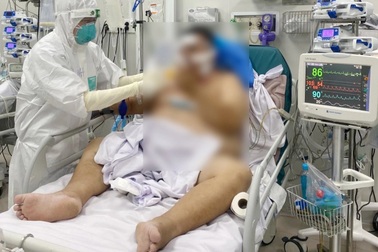 TPHCM: Bệnh nhân Covid-19 nặng 140kg may mắn thoát chết sau khi trụy tim