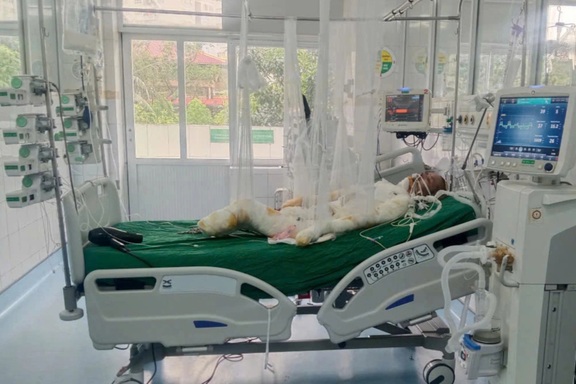 Hơn 900 triệu đồng tiếp sức anh Bằng bị bỏng khi chữa cháy rừng