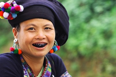 “Yêu nhau sau những buổi nhuộm răng!”