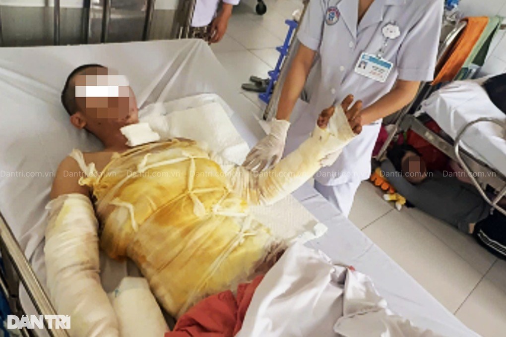 Sửa đèn bảng hiệu, người đàn ông 32 tuổi bị điện phóng gây bỏng nặng - 1 Sửa đèn bảng hiệu, người đàn ông 32 tuổi bị điện phóng gây bỏng nặng - 1