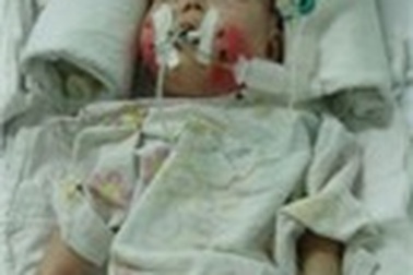 Toà án có quyền hạn chế quyền nuôi dưỡng của cha mẹ bé Nhân Ái