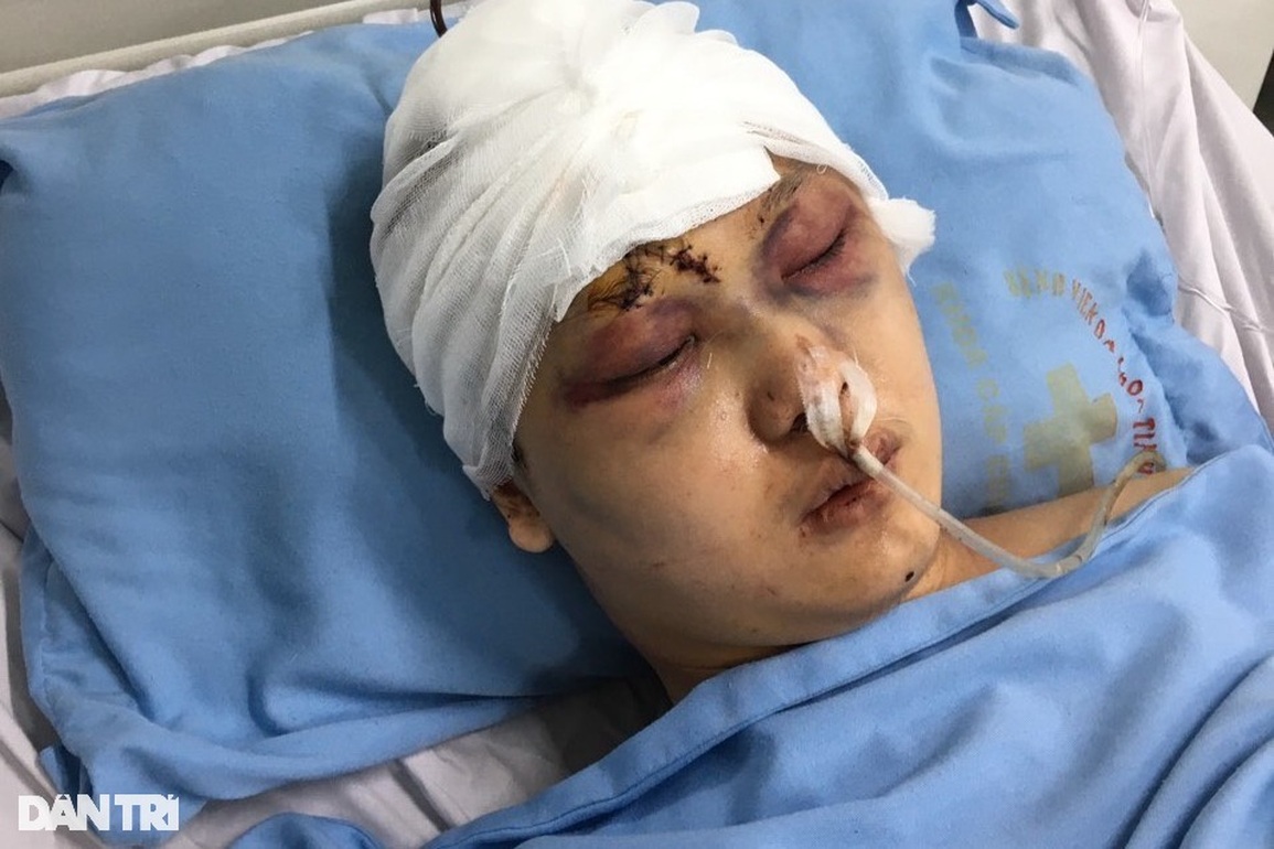 Bỏ học chăm mẹ bệnh, bố thần kinh, cậu sinh viên gặp nạn vô cùng nguy kịch - 1 Bỏ học chăm mẹ bệnh, bố thần kinh, cậu sinh viên gặp nạn vô cùng nguy kịch - 1