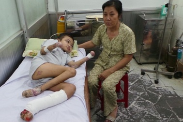 Bệnh nhân rụng dần chân tay mắc chứng bệnh cực hiếm