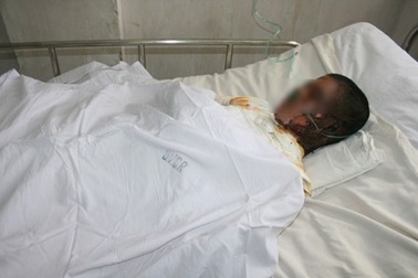 Bị điện giật nguy kịch vì lấy dép bằng cây sắt