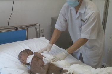 Cứu sống bé gái bị cha mẹ bỏ mặc vì bị...“ma rừng bắt tội”