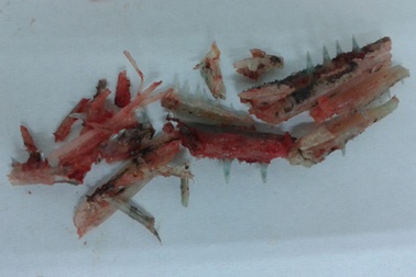 Xác định được loài cá đâm trọng thương du khách người Nga 