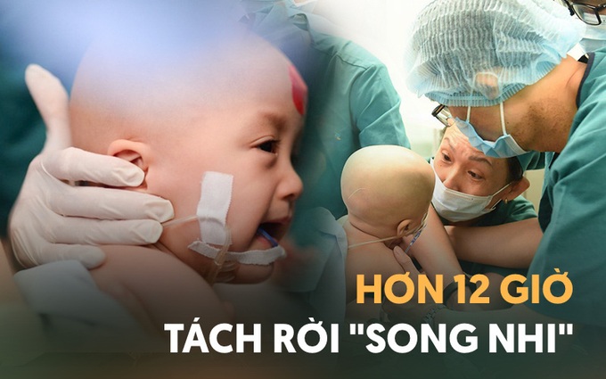Cặp song sinh Trúc Nhi - Diệu Nhi đã tỉnh lại sau ca mổ hơn 12 tiếng, đang được chăm sóc tích cực - Ảnh 3. Cặp song sinh Trúc Nhi - Diệu Nhi đã tỉnh lại sau ca mổ hơn 12 tiếng, đang được chăm sóc tích cực - Ảnh 3.