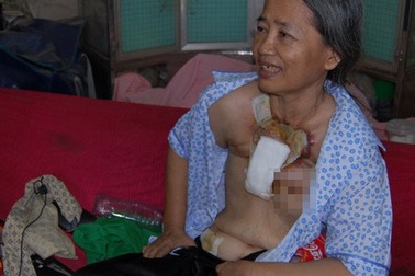 Nữ biệt động Sài Gòn mang 100 khối u ác tính đi bộ xuyên Việt