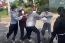 Nữ sinh miền Tây bị 7 người đánh hội đồng gãy xương mũi, chấn thương đầu