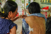 Người phụ nữ ôm con đầy thương tích trốn giữa đêm: Lời khai kẻ cuồng ghen