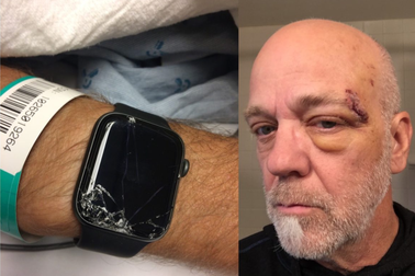 Apple Watch cứu mạng một người đàn ông Mỹ nhờ tính năng chẳng mấy ai để ý