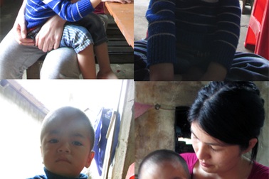 3 căn bệnh quái ác "đè nặng" bé trai 3 tuổi