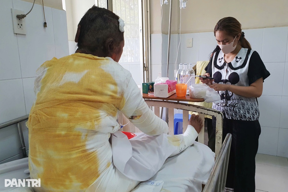 Người mẹ bị con trai tạt xăng đốt: Tôi không giận con - 4 Người mẹ bị con trai tạt xăng đốt: Tôi không giận con - 4