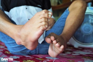 Nghị lực phi thường của cậu bé viết chữ, xỏ chỉ, đánh máy bằng chân