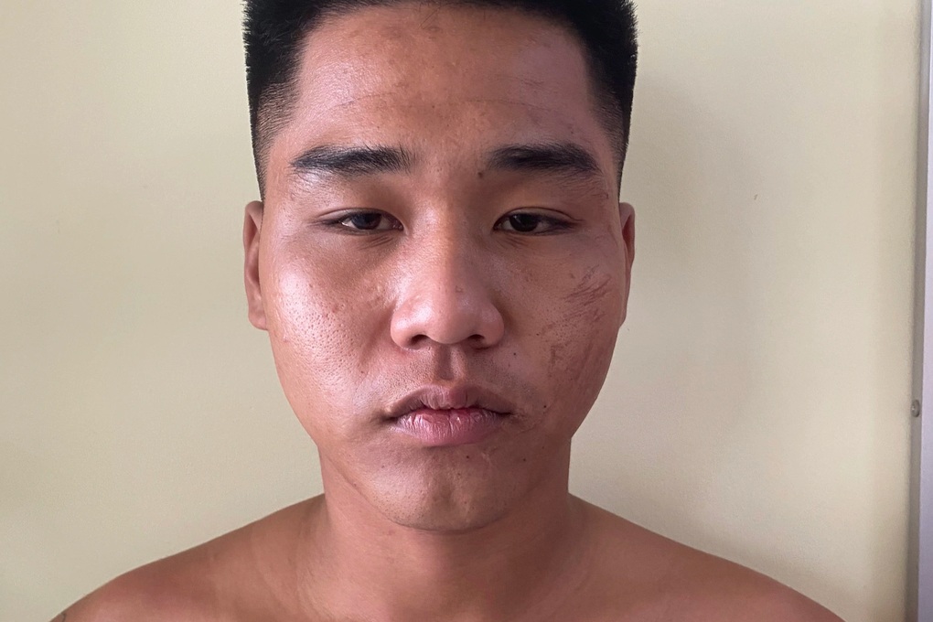 Vụ con nợ thuê giang hồ chém chủ nợ: Bắt thêm một người đang lẩn trốn - 1 Vụ con nợ thuê giang hồ chém chủ nợ: Bắt thêm một người đang lẩn trốn - 1