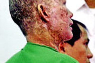 Uống thực phẩm chức năng Vision rồi... nhập viện! 