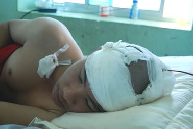 Một học sinh bị đánh đập dã man  