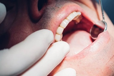 Vì sao răng ê buốt khi ăn uống đồ lạnh?