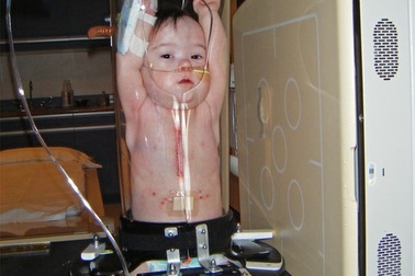  Sự thật về bức ảnh em bé "mắc kẹt trong ống nghiệm" 