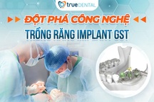 Trồng răng implant với công nghệ GST tại True Dental