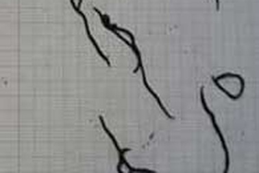 Sinh vật lạ ở Quảng Bình thuộc nhóm sán lông