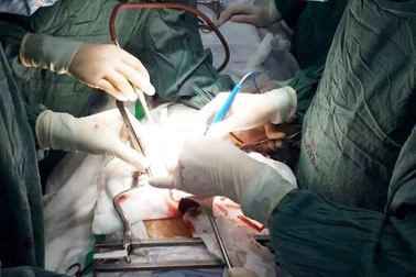 Cứu sống bệnh nhân vỡ tim trong gang tấc