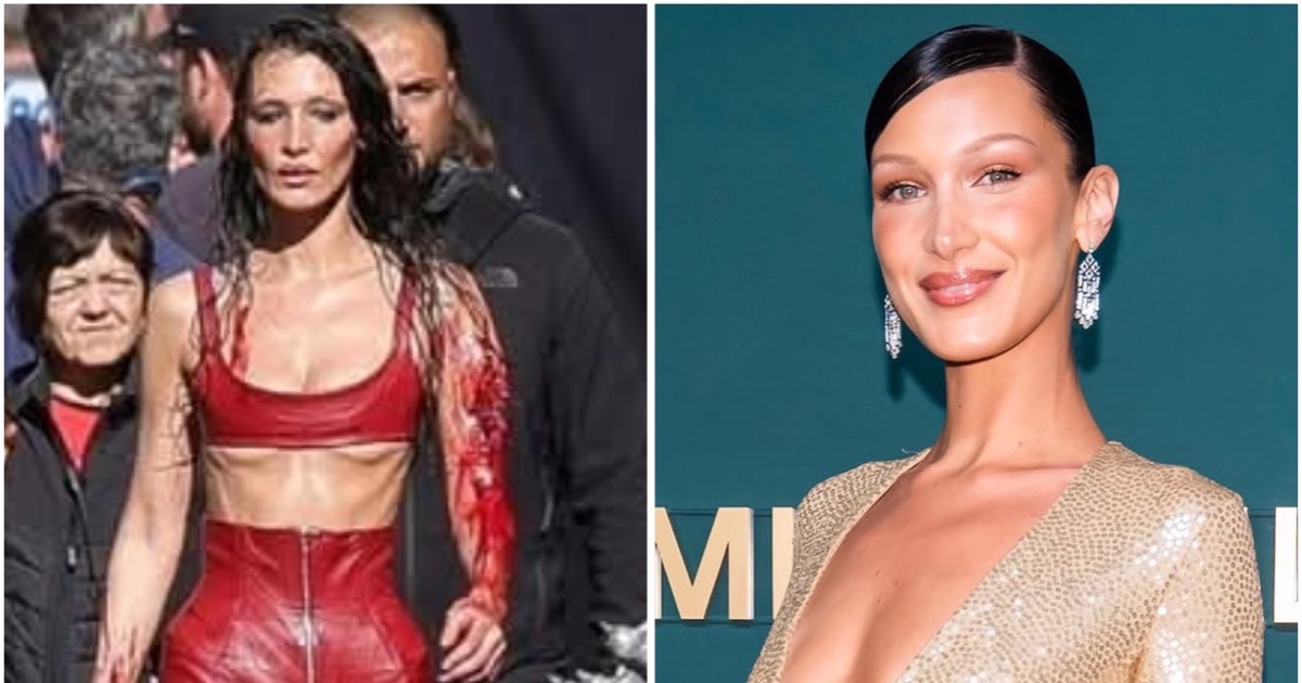 View - Hình ảnh gầy gò gây lo lắng của mỹ nhân sở hữu gương mặt tỷ lệ "vàng" | Báo Dân trí