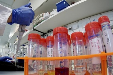 Nhật Bản sẽ thử nghiệm lâm sàng thuốc điều trị HIV cho virus corona