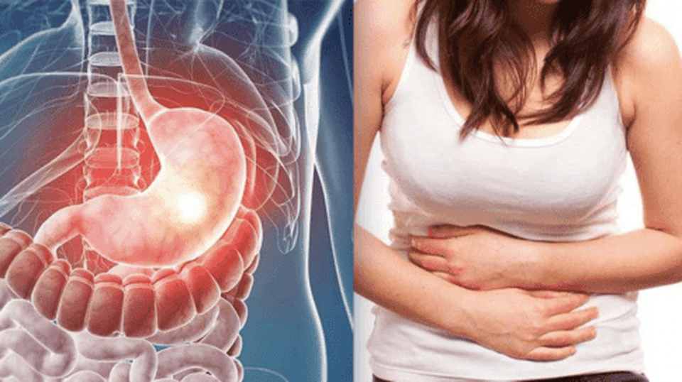 U xơ tử cung và những nguy cơ khó lường chị em cần biết - 4 U xơ tử cung và những nguy cơ khó lường chị em cần biết - 4